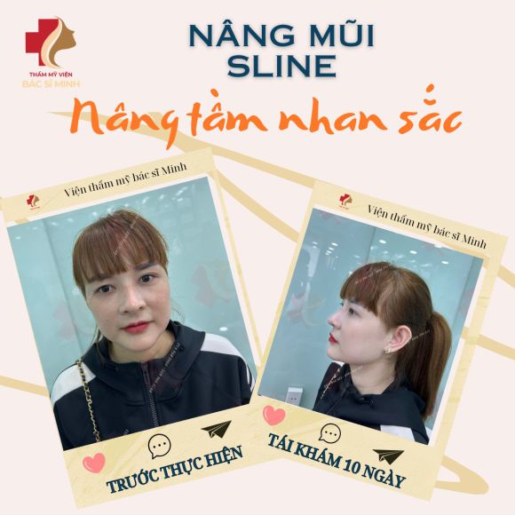 Thẩm mỹ viện - Phun xăm