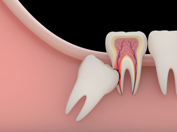 Nha khoa