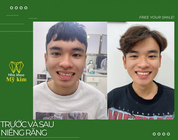 nha khoa uy tín, giá cả phải chăng tại Bình Dương – Địa chỉ vàng cho nụ cười khỏe đẹp