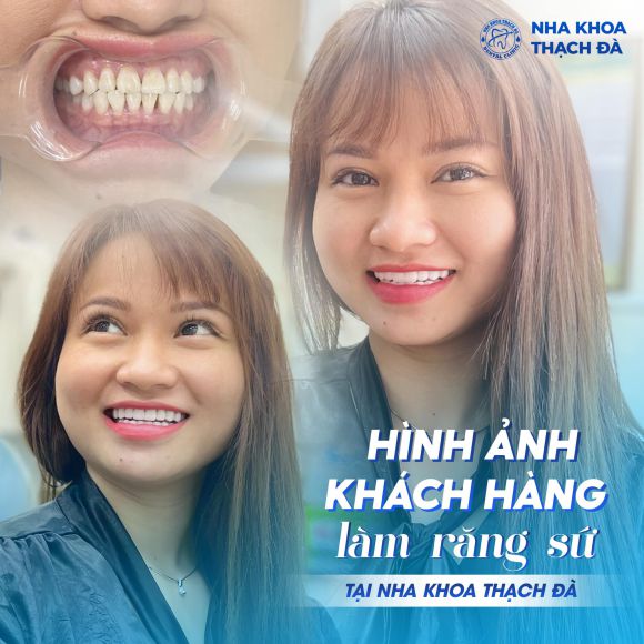 Nha khoa