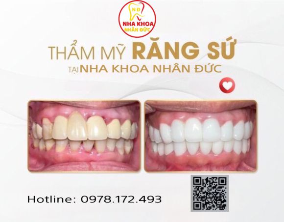 Nha khoa