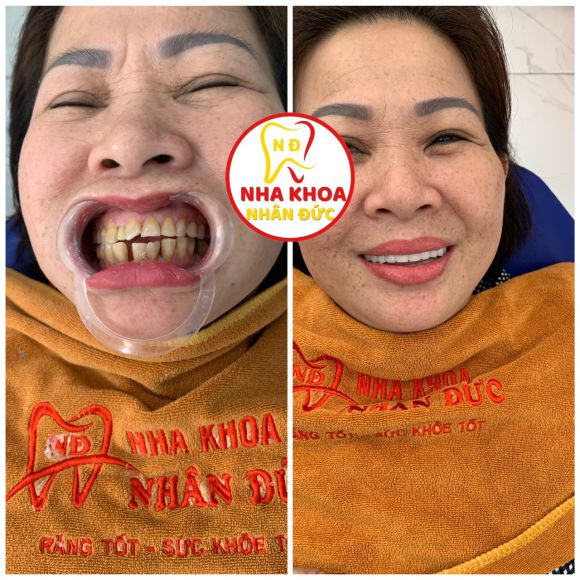 Nha khoa