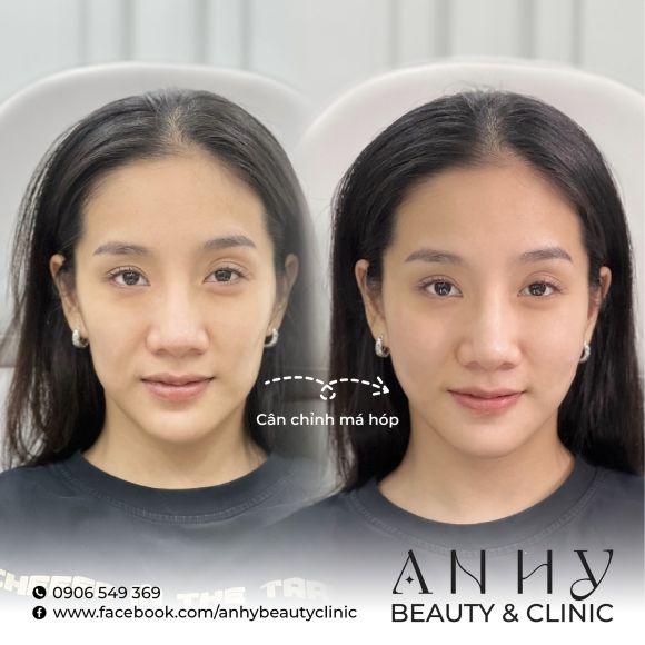 Thẩm mỹ viện - Phun xăm