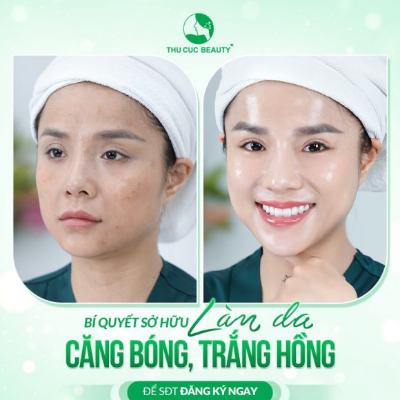 Làm đẹp