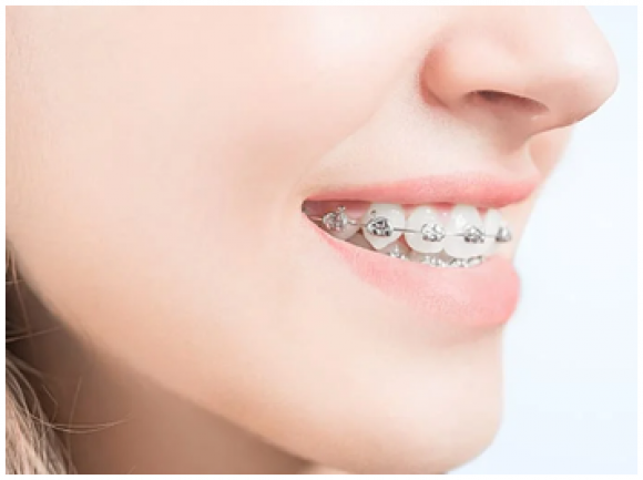 nha khoa uy tín, giá cả phải chăng tại Bình Dương – Địa chỉ vàng cho nụ cười khỏe đẹp