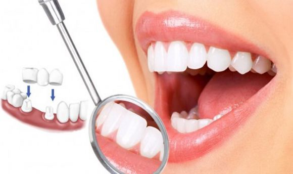 nha khoa uy tín, giá cả phải chăng tại Bình Dương – Địa chỉ vàng cho nụ cười khỏe đẹp