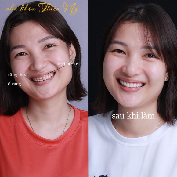 Làm đẹp