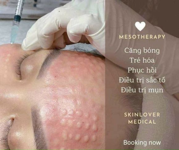 Spa - Massage