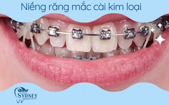 nha khoa uy tín, giá cả phải chăng tại Bình Dương – Địa chỉ vàng cho nụ cười khỏe đẹp