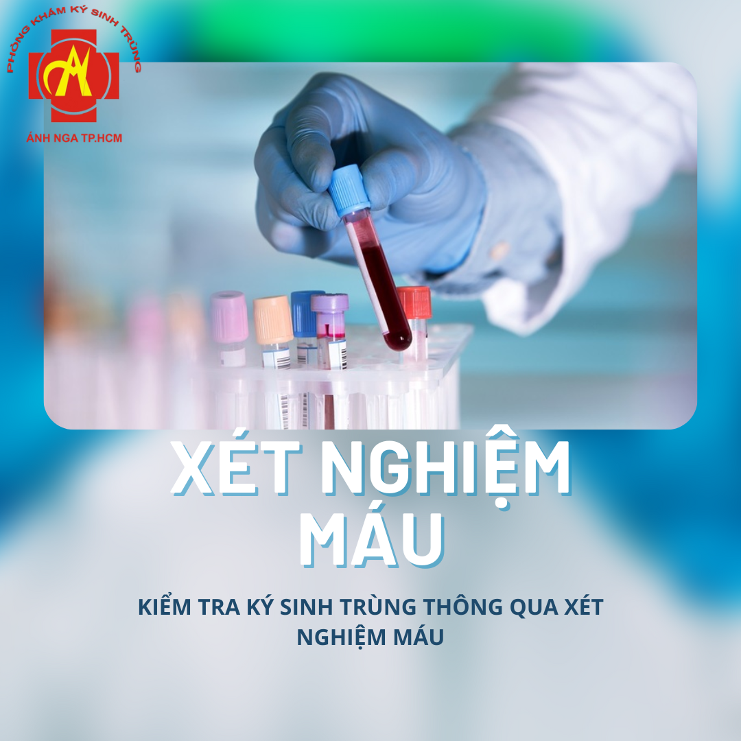 Top 3 Lý Do Nên Chọn Phòng Khám Quốc Tế Ánh Nga Để Điều Trị Ký Sinh Trùng