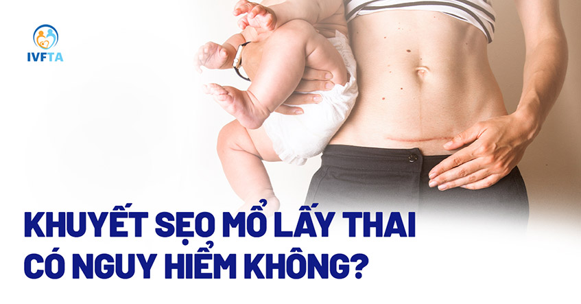 Thai Bám Sẹo Mổ Lấy Thai: Nguy Cơ Tiềm Ẩn Và Giải Pháp Điều Trị Hiệu Quả - Phòng khám sản phụ khoa bác sĩ Bành Kim Linh