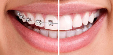 Top 3 phòng khám nha khoa uy tín chất lượng tại Đồng Nai