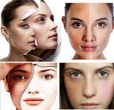 TOP 3 SPA ĐIỀU TRỊ NÁM TÀN NHANG - LẤY LẠI VẺ ĐẸP CHO CHỊ EM TẠI QUẬN 10