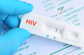 Top 3 Đơn Vị Xét Nghiệm HIV Tốt Nhất Tại Hà Nội