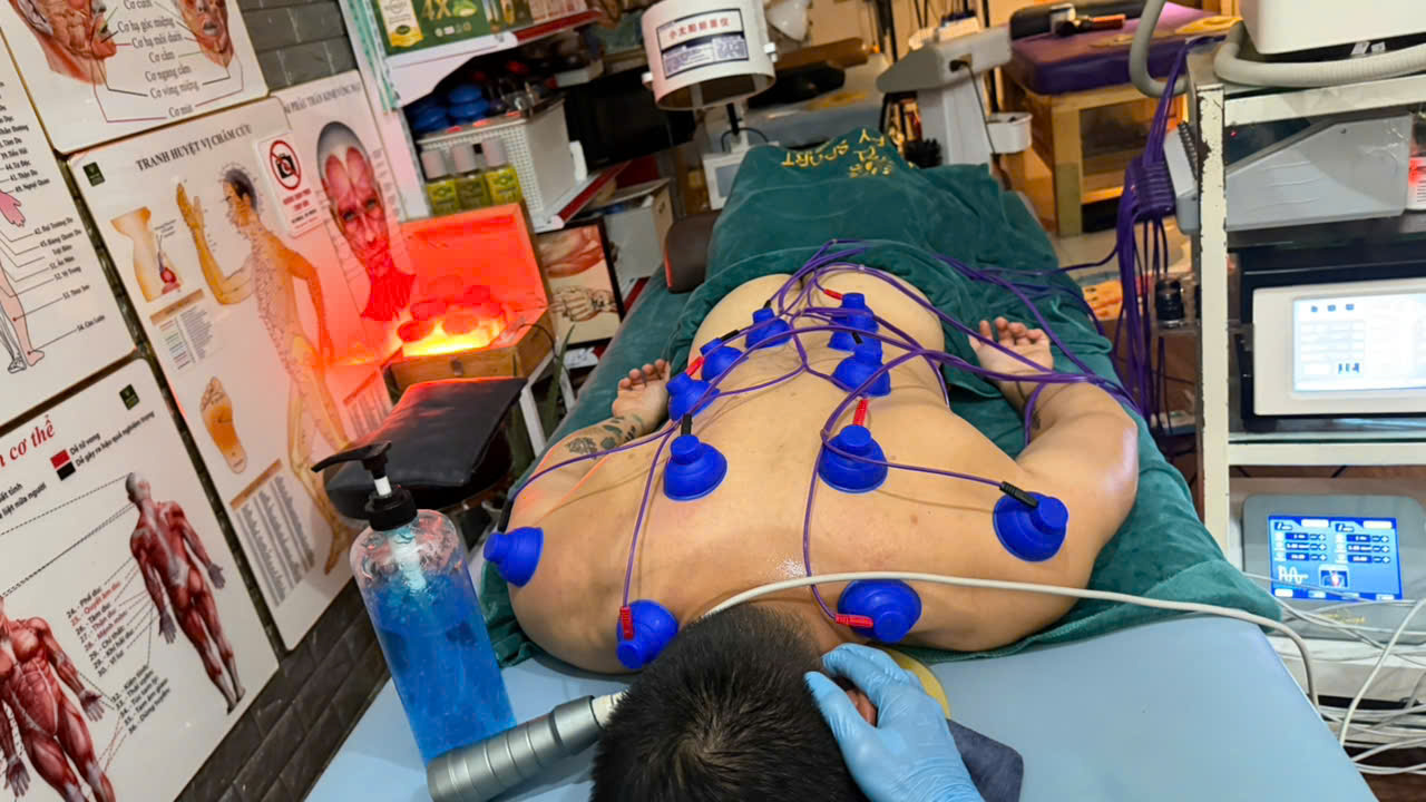 Top 3 Phương Pháp Trị Liệu Thể Thao Hiệu Quả Giúp Phục Hồi Nhanh Chóng