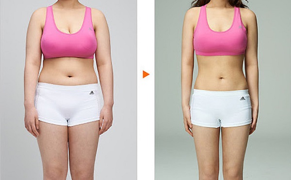 TOP 3 ĐỊA ĐIỂM GIẢM MỠ UY TÍN VÀ CHẤT LƯỢNG NHẤT QUẬN PHÚ NHUẬN