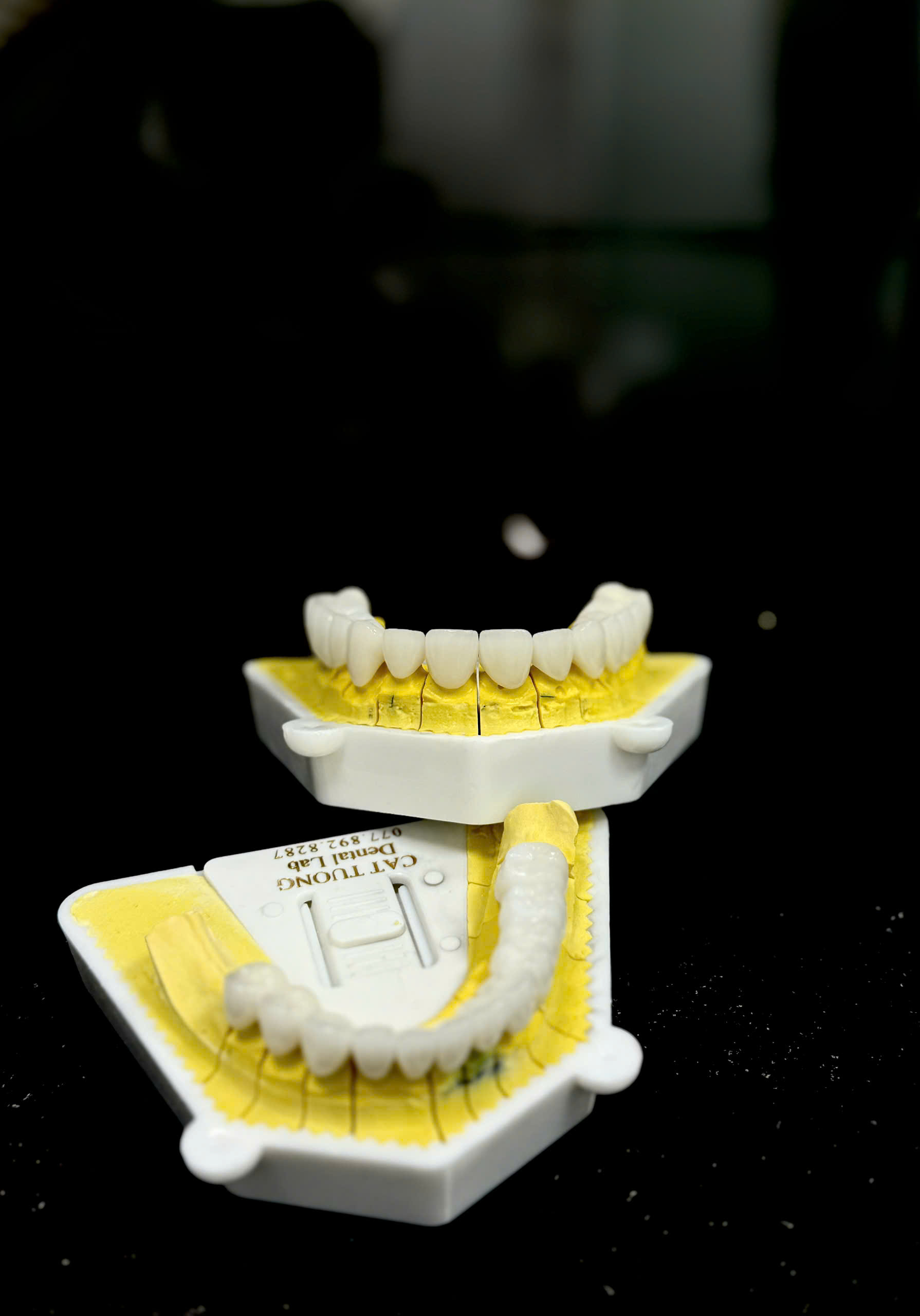 labo Cát Tường Labo Cát Tường TP.HCM labo nha khoa uy tín labo phục hình răng labo răng sứ TP.HCM labo chế tác răng giả labo nha khoa chất lượng cao phục hình nha khoa chính xác labo răng tháo lắp TP.HCM labo nha khoa chuyên nghiệp