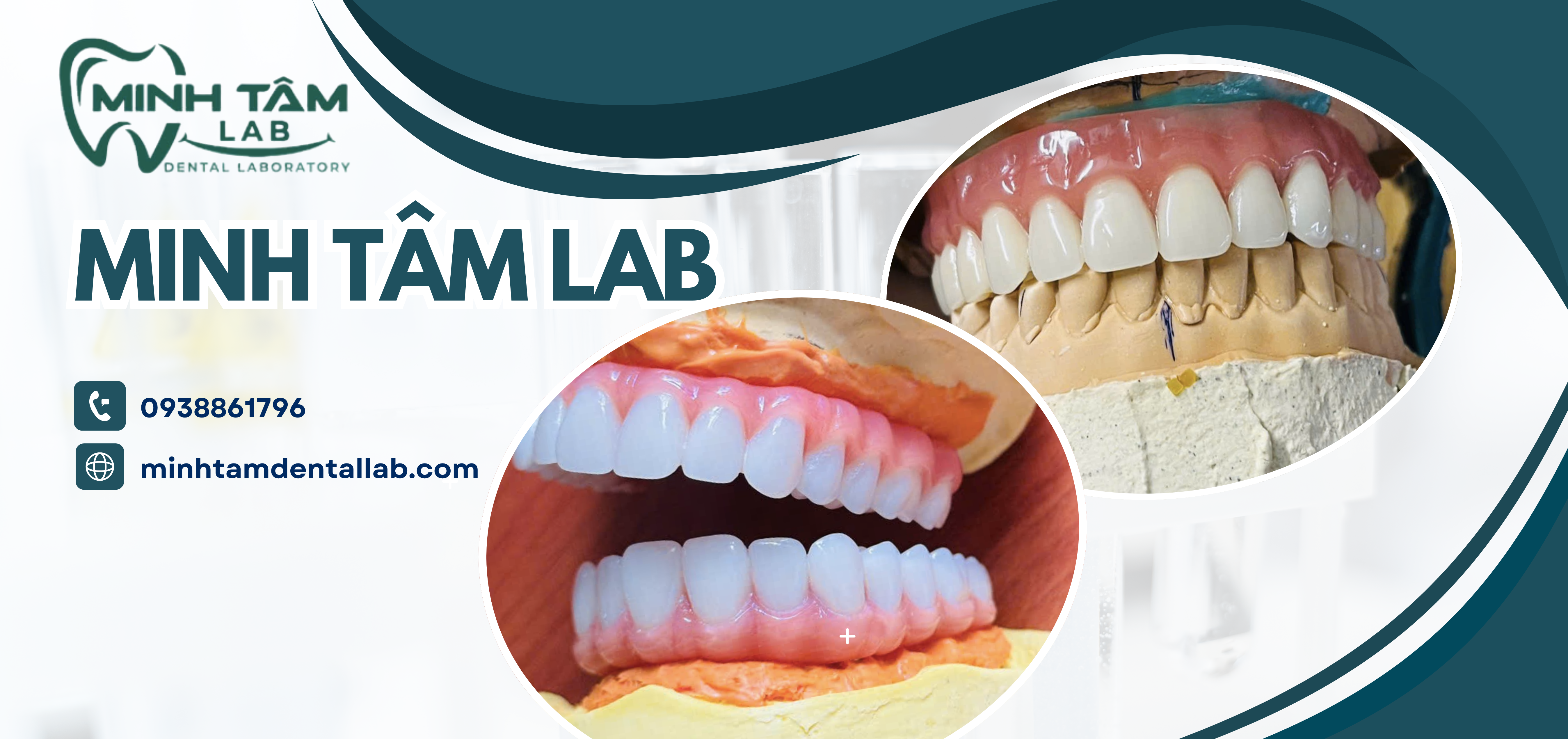 Labo Minh Tâm: Nâng Tầm Nụ Cười Việt - Đồng Hành Cùng Nha Sĩ Kiến Tạo Vẻ Đẹp Hoàn Mỹ